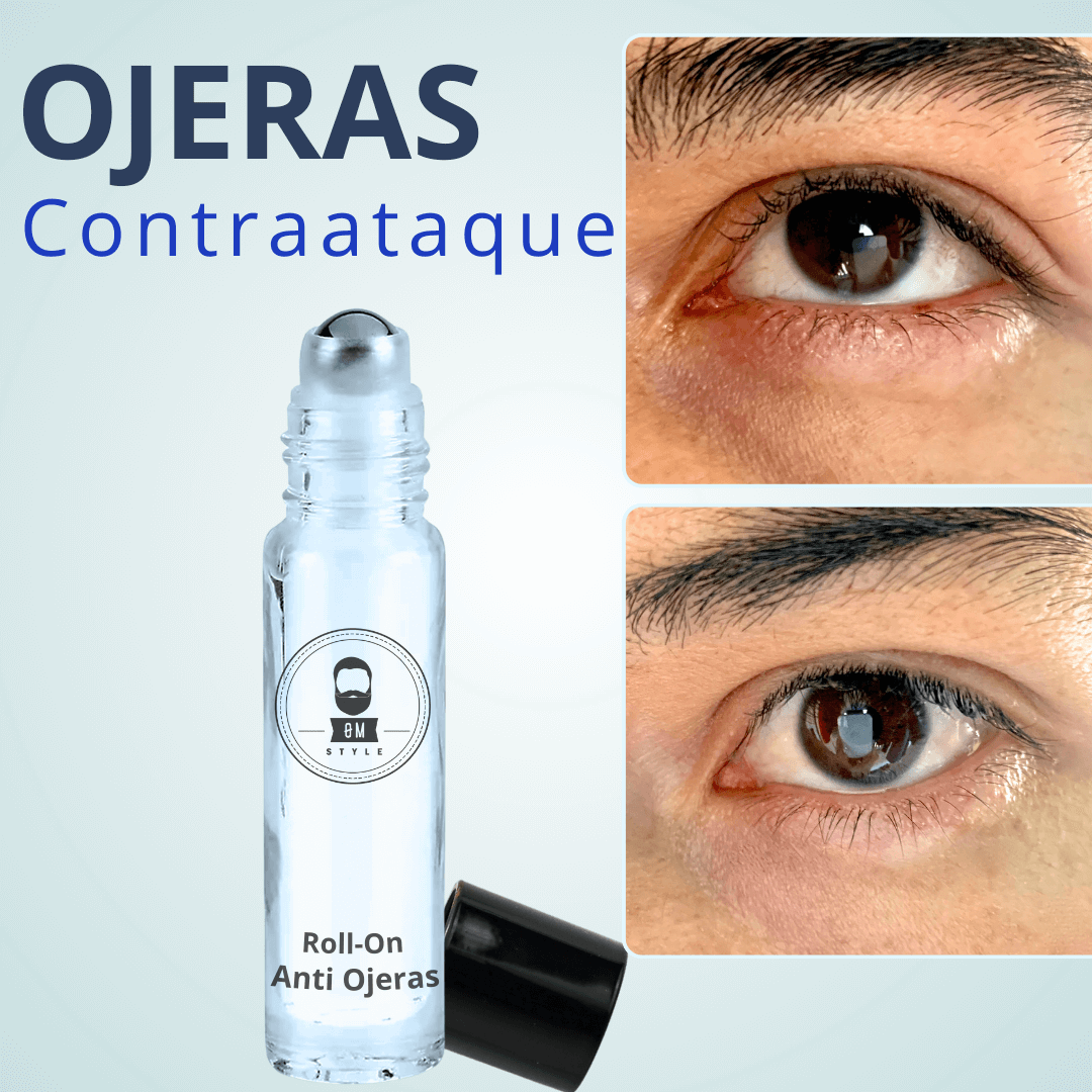 Kit Anti Ojeras