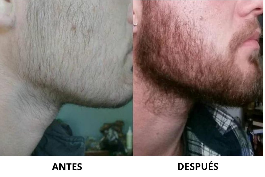 Kit Crecimiento Barba - OM Style Mexico