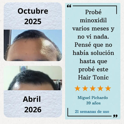 Hair Tonic - Crecimiento Capilar