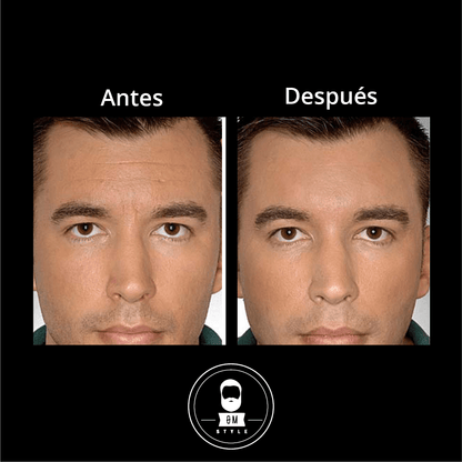 Sérum Anti Edad