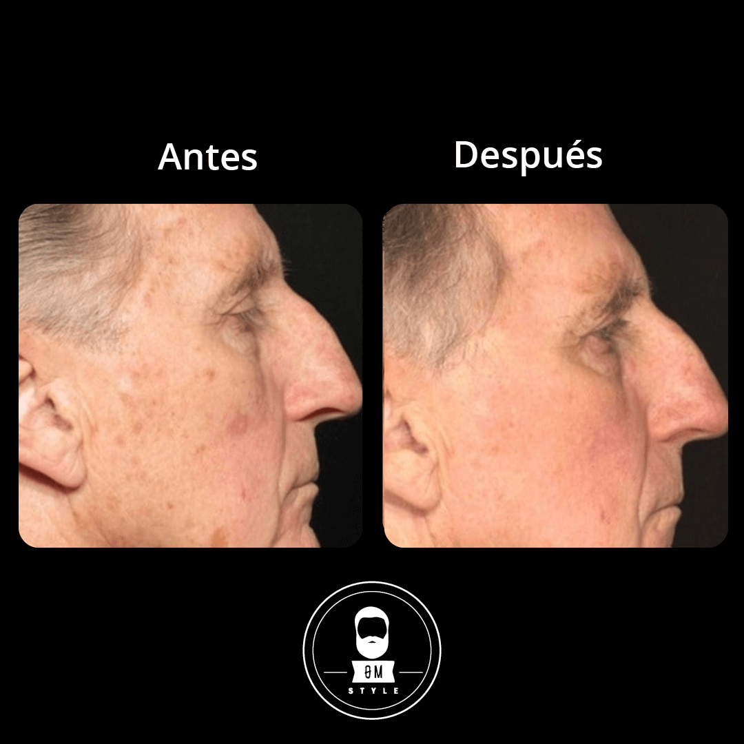 Sérum Anti Edad