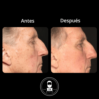 Sérum Anti Edad