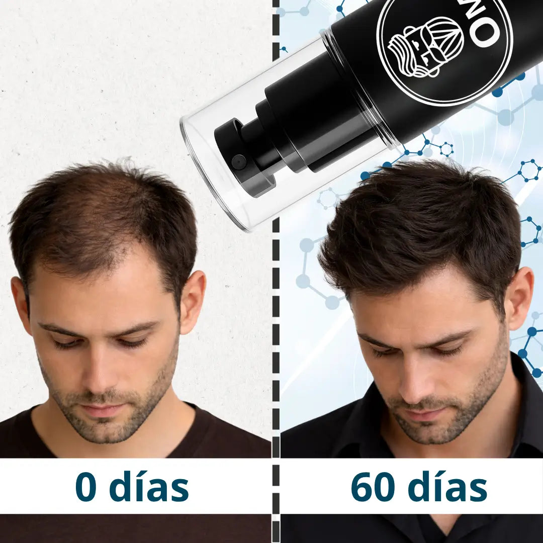 Hair Tonic - Crecimiento Capilar