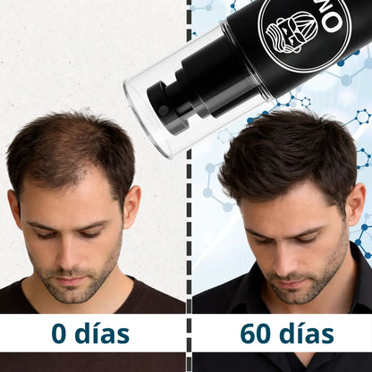 Hair Tonic - Crecimiento Capilar