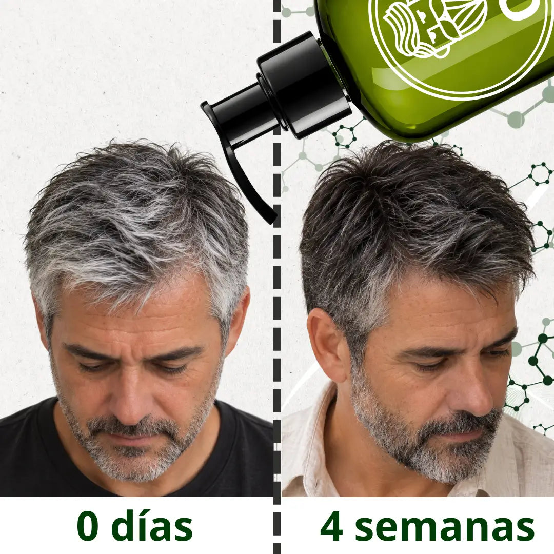 Shampoo - Anti Canas