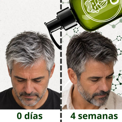 Shampoo - Anti Canas