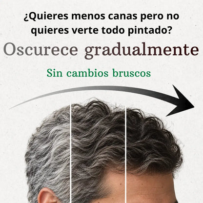 Shampoo - Anti Canas