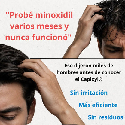 Hair Tonic - Crecimiento Capilar
