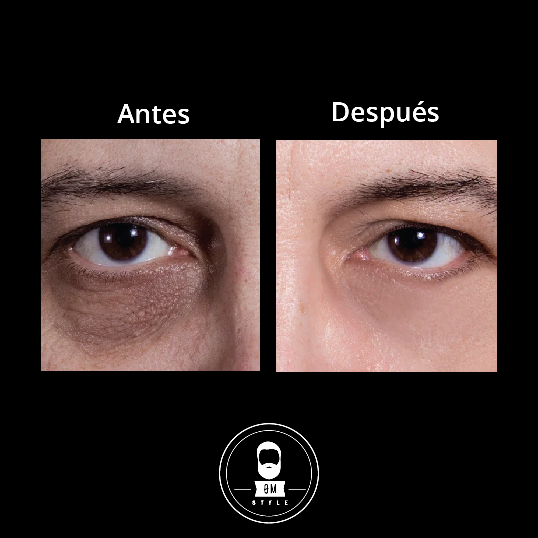 Anti-Dark Circles Roll On